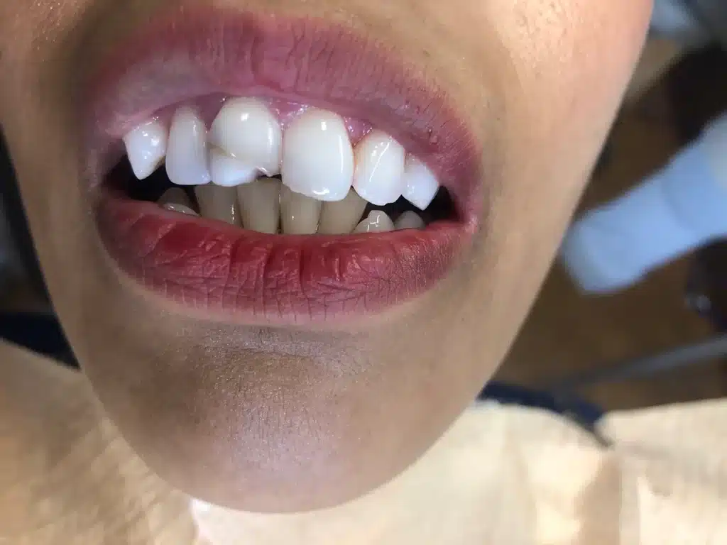 Smile Gallery Twin Branch Dental Mishawaka, IN 46544